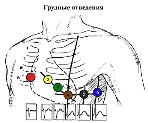 Принцип работы электродов