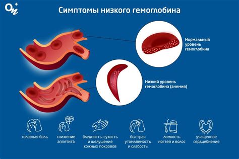 Причины низкого гемоглобина при нормальном сывороточном железе