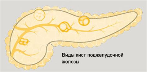 Причины образования кисты на железе