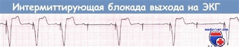 Проблемы с электродом и искрообразующим блоком