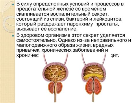 Процедура массажа предстательной железы: основные методики