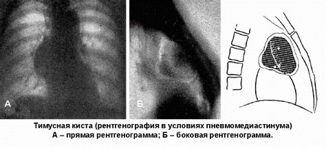 Раздел 2: Постукивание по вилочковой железе