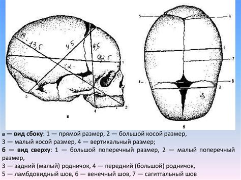 Размер и форма буриной головки