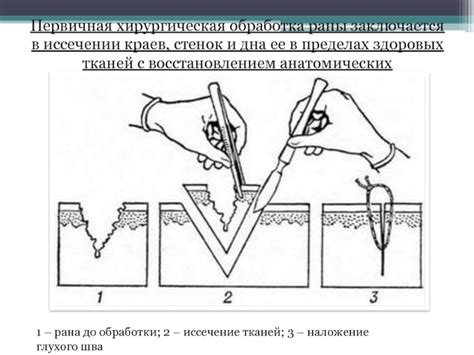 Раскрой основы и обработка ее краев