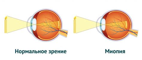 Реальные причины ухудшения зрения при использовании смартфонов