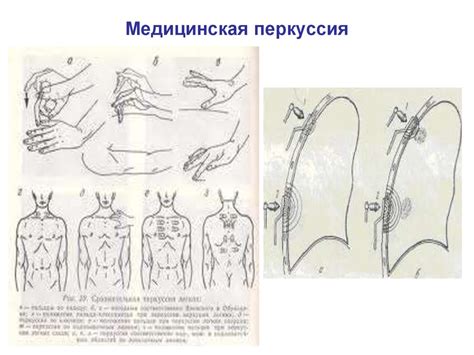 Рекомендации по проведению массажа грудной железы