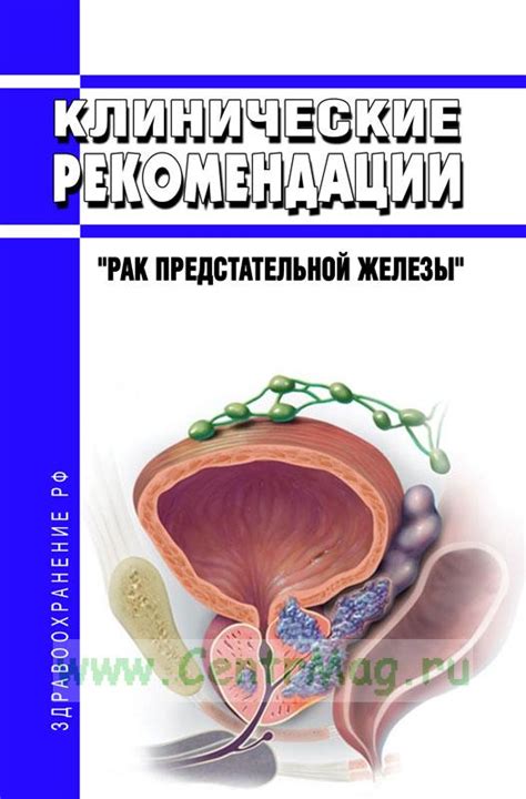 Рекомендации по проведению массажа предстательной железы