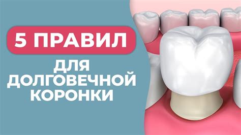 Рекомендации по уходу за безметаллической коронкой: как продлить срок службы