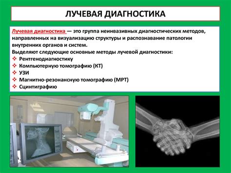 Рентгеновский метод: определение плотности с использованием рентгеновского излучения