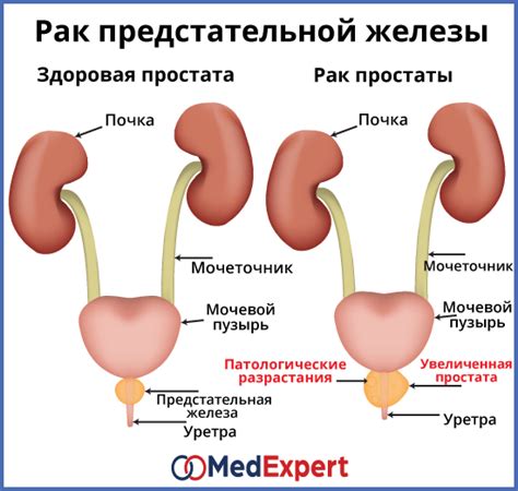 Репродуктивная функция предстательной железы