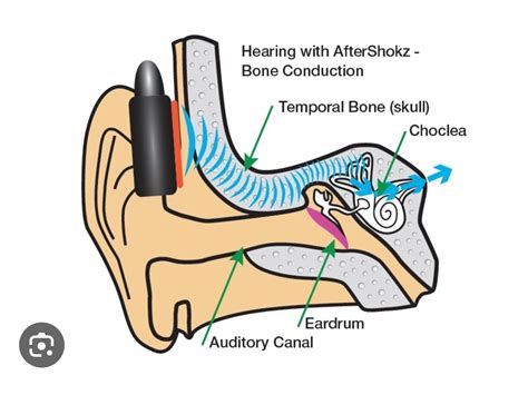 Решение проблемы потери слуха: принцип работы телефона с костной проводимостью