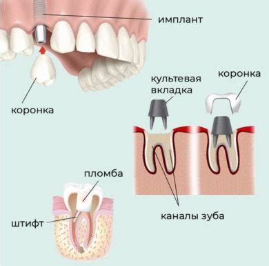 Роль восстановления для металлов