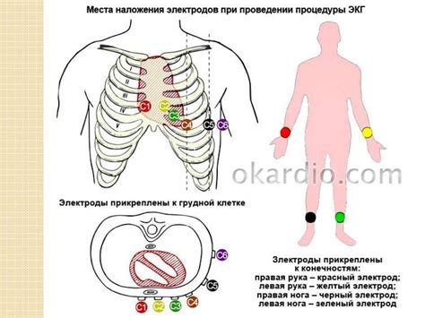 Сдача электродов: правила и условия