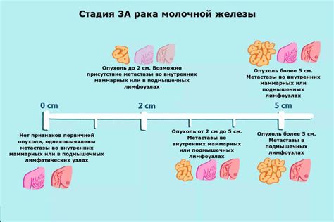 Симптомы застуды грудной железы