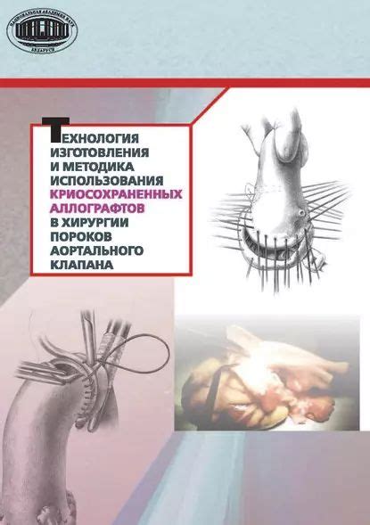 Специфика использования металла в хирургии