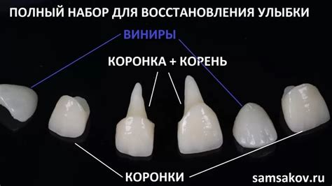 Стоимость металлокерамических коронок