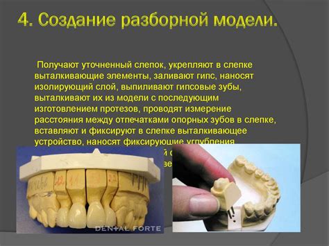 Технология создания металлокерамической коронки