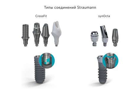 Типы искусственных металлических имплантатов в медицине