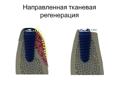 Тканевая регенерация