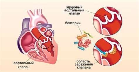 Удаление красно-бурого налета на железе