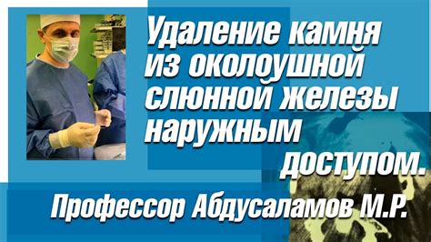 Удаление слюнной железы: безопасно или нет?