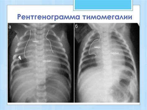 Удалять вилочковую железу у новорожденных животных опасно!