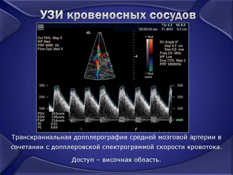 Ультразвуковые методы анализа