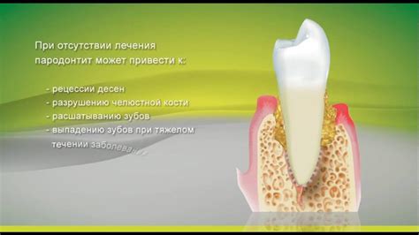 Уменьшение дислокационной подвижности