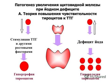 Уровень тиреоидных гормонов