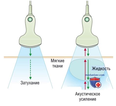 Усиление структуры