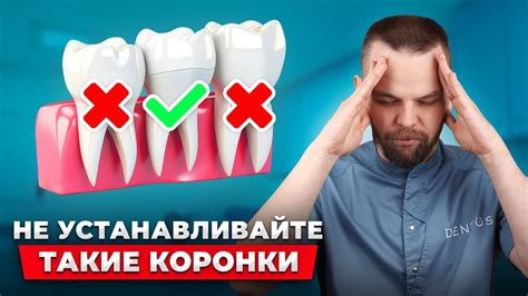 Факторы, о которых нужно помнить при выборе коронок матрикс