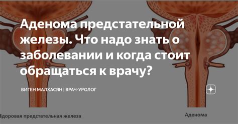 Факты и мифы о взаимосвязи молока и предстательной железы: что говорят исследования?