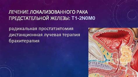 Физиотерапевтические методы лечения предстательной железы