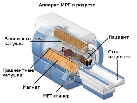 Что такое МРТ телефон и как он работает