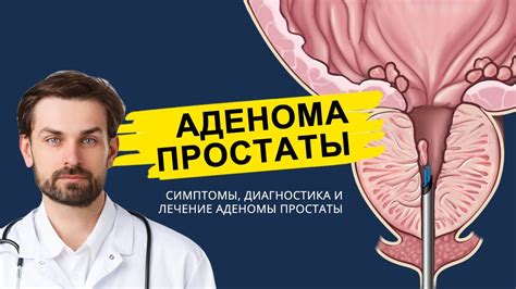 Что такое аденома предстательной железы?