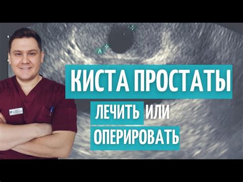 Что такое киста предстательной железы?