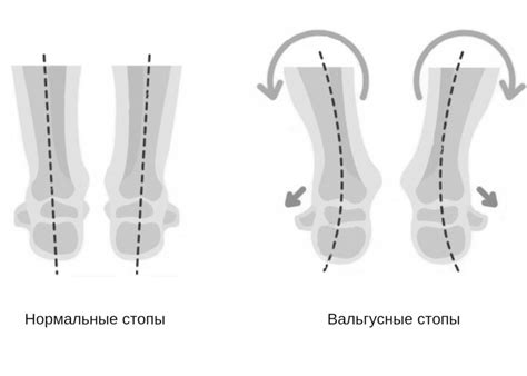 Что такое контактная деформация