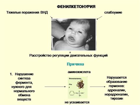 Что такое наследственные болезни обмена металлов?