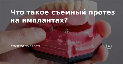 Что такое съемный полуфутляр?