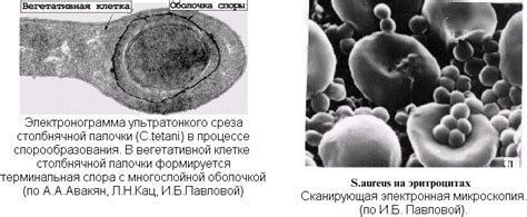 Электронная микроскопия в исследовании поверхностных дефектов