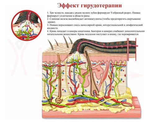 Эффективность лечения пиявками в Пиявита Темрюк