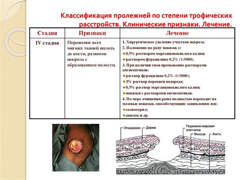  Причины возникновения лужения 